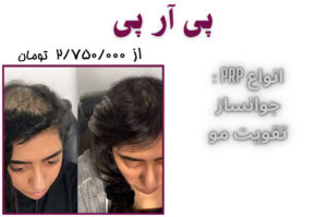 prp