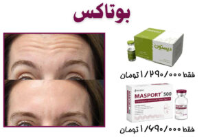 بوتاکس