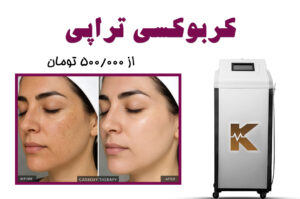 کربوکسی تراپی
